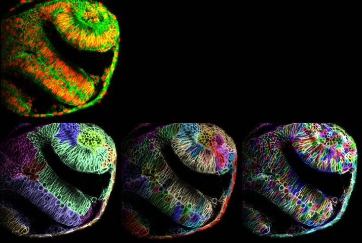 Multi-scale segmentation of neural region in zebrafish embryo at 12 hours post fertilization.