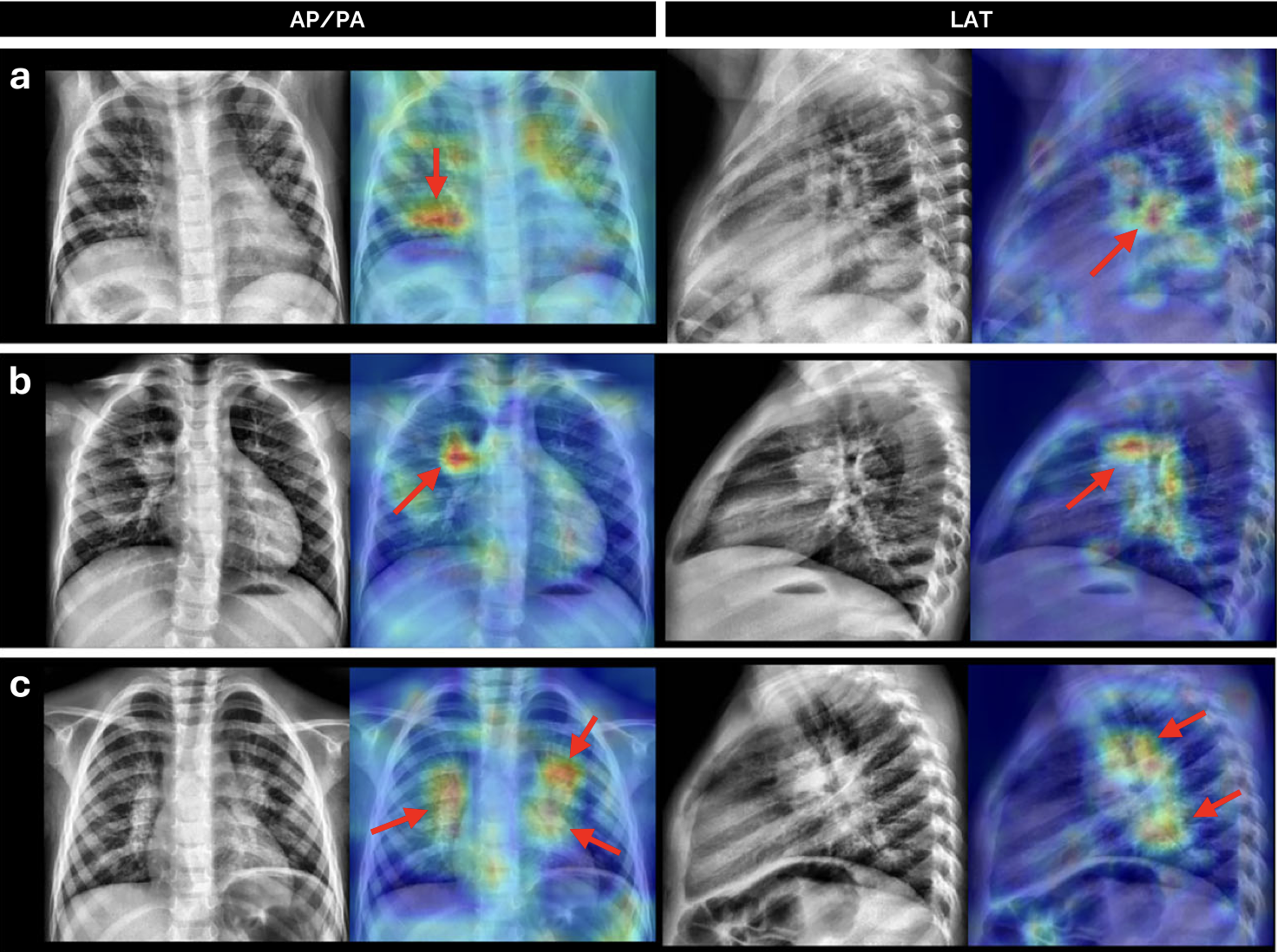 Grupo de Imágenes Biomédicas